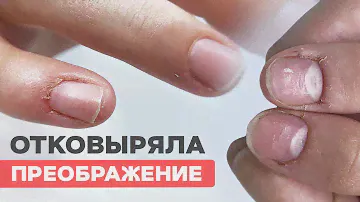 Как сделать наращивание ногтей | Верхние формы
