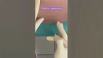 Работа невролога.