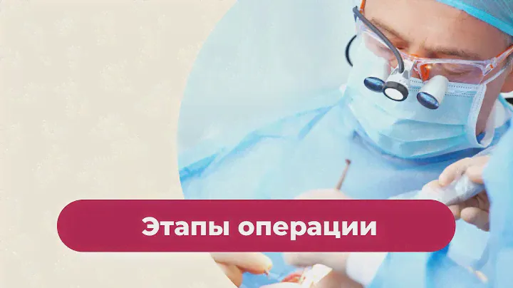 Этапы операции. Врач стоматолог. Москва.Клиника Элит Дента.