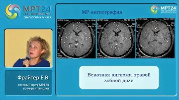 «Диагностические находки в практике врача МРТ (нейрососудистая патология)».