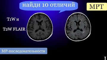 Базовые лекции по МРТ / МР-последовательности: разница  между T1W и T2W FLAIR изображениями