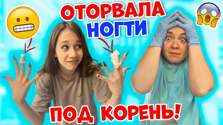 Ксюша СЛОМАЛА под КОРЕНЬ XXL Ногти😱👉 Лера СПАСАЕТ